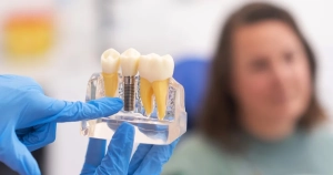 Eine Hand im blauen Handschuh zeigt an einem Zahnmodell ein Implantat zwischen zwei natürlichen Zähnen; im Hintergrund sitzt unscharf eine Patientin.